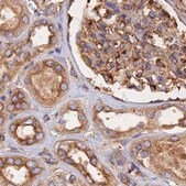 Anti-DCTN2 antibody produced in rabbit Prestige Antibodies&#174; Powered by Atlas Antibodies, affinity isolated antibody, buffered aqueous glycerol solution