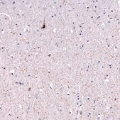 Monoclonal Anti-SST antibody produced in mouse Prestige Antibodies® Powered by Atlas Antibodies, clone CL15076, purified antibody (Protein A)