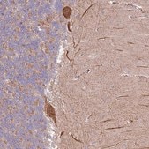 Anti-DTD2 antibody produced in rabbit Prestige Antibodies&#174; Powered by Atlas Antibodies, affinity isolated antibody, buffered aqueous glycerol solution