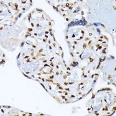 Anti-Phospho-ATF2-T69/71 antibody produced in rabbit