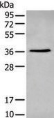 Anti-NHEJ1 affinity isolated antibody