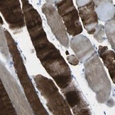 Anti-PHKG1 antibody produced in rabbit Prestige Antibodies&#174; Powered by Atlas Antibodies, affinity isolated antibody, buffered aqueous glycerol solution