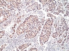 Anti-p70S6K Rabbit Monoclonal Antibody clone RM438, affinity purified immunoglobulin