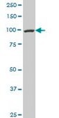 Monoclonal Anti-PCAF antibody produced in mouse clone 5E5, purified immunoglobulin, buffered aqueous solution