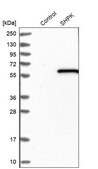 Anti-SHPK antibody produced in rabbit Prestige Antibodies® Powered by Atlas Antibodies, affinity isolated antibody, buffered aqueous glycerol solution