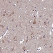 Anti-UBE2O antibody produced in rabbit affinity isolated antibody, buffered aqueous glycerol solution