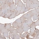 Anti-TPD52 antibody produced in rabbit Prestige Antibodies&#174; Powered by Atlas Antibodies, affinity isolated antibody, buffered aqueous glycerol solution