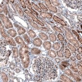 Monoclonal Anti-LAPTM4B antibody produced in mouse Prestige Antibodies&#174; Powered by Atlas Antibodies, clone CL5289, purified immunoglobulin, buffered aqueous glycerol solution