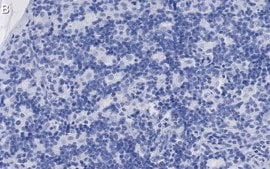 Anti-CD8β Antibody, clone 1H21 ZooMAb® Rabbit Monoclonal recombinant, expressed in HEK 293 cells