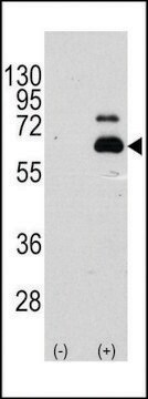 ANTI-S6K (RPS6KB1) (S404) antibody produced in rabbit affinity isolated antibody, buffered aqueous solution