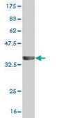 Monoclonal Anti-PPP3CA antibody produced in mouse clone 2G8, purified immunoglobulin, buffered aqueous solution