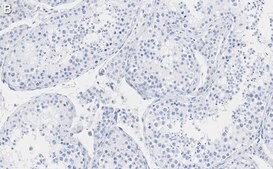 Anti-FKBP52 Antibody, clone 4H21 ZooMAb&#174; Rabbit Monoclonal recombinant, expressed in HEK 293 cells