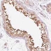 Anti-GEMIN2 antibody produced in rabbit Prestige Antibodies&#174; Powered by Atlas Antibodies, affinity isolated antibody, buffered aqueous glycerol solution