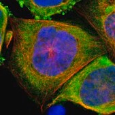 Anti-PSMD10 antibody produced in rabbit Prestige Antibodies&#174; Powered by Atlas Antibodies, affinity isolated antibody, buffered aqueous glycerol solution