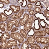 Anti-MT-CO1 antibody produced in rabbit Prestige Antibodies&#174; Powered by Atlas Antibodies, affinity isolated antibody, buffered aqueous glycerol solution