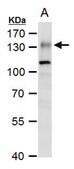 Anti-ENPP1 antibody produced in rabbit affinity isolated antibody, buffered aqueous solution