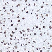 Anti- Histone H1.0 antibody produced in rabbit