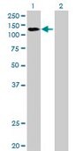 Anti-DDX42 antibody produced in mouse purified immunoglobulin, buffered aqueous solution