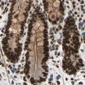 Anti-CHAMP1 antibody produced in rabbit Prestige Antibodies® Powered by Atlas Antibodies, affinity isolated antibody, buffered aqueous glycerol solution