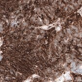 Anti-CD44 antibody produced in mouse Prestige Antibodies® Powered by Atlas Antibodies, clone CL13324, purified by using Protein A, buffered aqueous glycerol solution