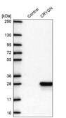 Anti-CRYGN antibody produced in rabbit Prestige Antibodies® Powered by Atlas Antibodies, affinity isolated antibody, buffered aqueous glycerol solution