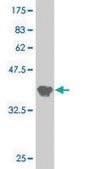 ANTI-SURB7 antibody produced in mouse clone 4B5, purified immunoglobulin, buffered aqueous solution