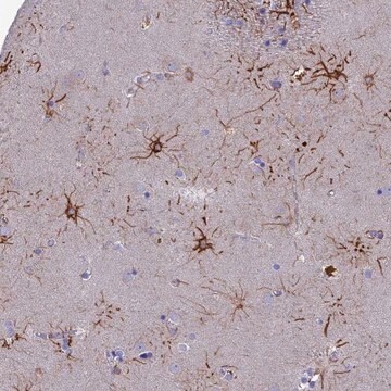 Anti-CYB561D2 antibody produced in rabbit Prestige Antibodies&#174; Powered by Atlas Antibodies, affinity isolated antibody, buffered aqueous glycerol solution