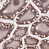 Anti-YIPF5 antibody produced in rabbit Prestige Antibodies&#174; Powered by Atlas Antibodies, affinity isolated antibody