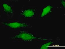 Monoclonal Anti-CAMK1D, (N-terminal) antibody produced in mouse clone 3H8, purified immunoglobulin, buffered aqueous solution