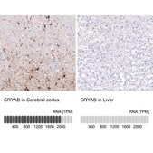 Monoclonal Anti-CRYAB antibody produced in mouse Prestige Antibodies® Powered by Atlas Antibodies, clone CL10765, purified antibody (Protein A)