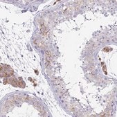 Anti-TMEM106B antibody produced in rabbit Prestige Antibodies&#174; Powered by Atlas Antibodies, affinity isolated antibody, buffered aqueous glycerol solution