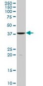 Monoclonal Anti-FUSIP1, (N-terminal) antibody produced in mouse clone 1G11, purified immunoglobulin, buffered aqueous solution