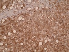 Anti-CYP7B1 Antibody, clone M17P3F2 clone M17P3F2, from mouse