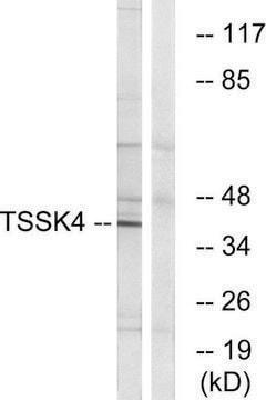 Anti-TSSK4 antibody produced in rabbit affinity isolated antibody