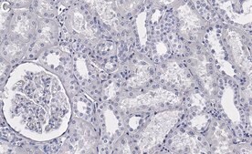 Anti-Raf-1 Antibody, clone 1I3 ZooMAb® Rabbit Monoclonal recombinant, expressed in HEK 293 cells