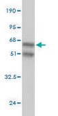 Monoclonal Anti-ANP32A antibody produced in mouse clone 2G11-4A5, purified immunoglobulin, buffered aqueous solution