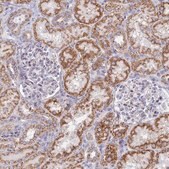 Anti-HS2ST1 antibody produced in rabbit Prestige Antibodies&#174; Powered by Atlas Antibodies, affinity isolated antibody, buffered aqueous glycerol solution