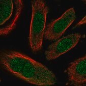 Anti-GALK2 antibody produced in rabbit Prestige Antibodies&#174; Powered by Atlas Antibodies, affinity isolated antibody, buffered aqueous glycerol solution