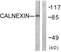 Anti-Calnexin, C-Terminal antibody produced in rabbit affinity isolated antibody