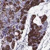 Anti-AAK1 antibody produced in rabbit Prestige Antibodies&#174; Powered by Atlas Antibodies, affinity isolated antibody, buffered aqueous glycerol solution