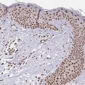 Anti-HOXA9 antibody produced in rabbit Prestige Antibodies&#174; Powered by Atlas Antibodies, affinity isolated antibody, buffered aqueous glycerol solution