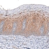 Monoclonal Anti-CLIP1 antibody produced in mouse Prestige Antibodies&#174; Powered by Atlas Antibodies, clone CL4844, purified immunoglobulin, buffered aqueous glycerol solution