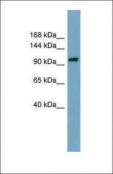 Anti-ELP2 antibody produced in rabbit affinity isolated antibody