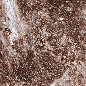 Anti-CD44 antibody produced in mouse Prestige Antibodies&#174; Powered by Atlas Antibodies, clone CL13319, purified by using Protein A, buffered aqueous glycerol solution