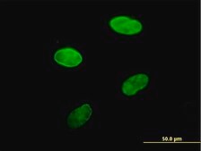 Anti-LBR antibody produced in mouse IgG fraction of antiserum, buffered aqueous solution