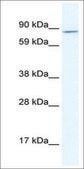 Anti-AHR (AB1) antibody produced in rabbit IgG fraction of antiserum