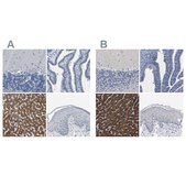 Anti-CYP2C8 antibody produced in rabbit Prestige Antibodies® Powered by Atlas Antibodies, affinity isolated antibody, buffered aqueous glycerol solution