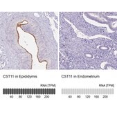 Anti-CST11 antibody produced in rabbit Prestige Antibodies® Powered by Atlas Antibodies, affinity isolated antibody, buffered aqueous glycerol solution