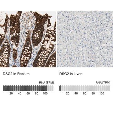 Anti-DSG2 antibody produced in rabbit Prestige Antibodies&#174; Powered by Atlas Antibodies, affinity isolated antibody, buffered aqueous glycerol solution