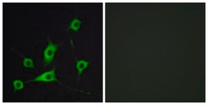 Anti-CRBP III antibody produced in rabbit affinity isolated antibody